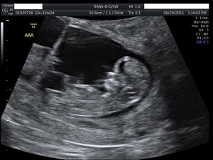 Baby%20A.jpg
