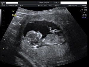 Baby%20B.jpg