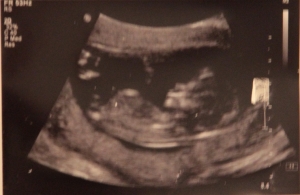 bean12Weeks.jpg