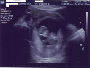 katamari.12week.scan.jpg