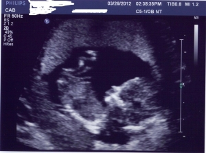 katamari.13weeks.jpg