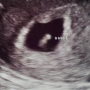 sweet%20baby%206%20w%205%20d.jpg