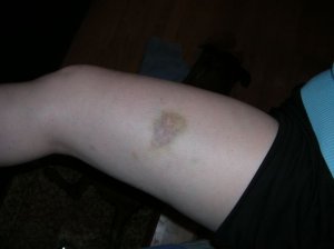 leg0001.jpg leg0001.jpg