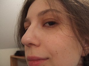 myfaceafter1.jpg