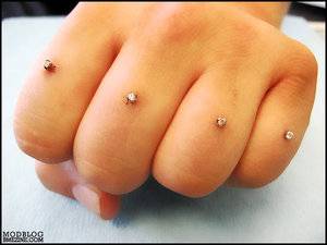 brassknuckleimplants.jpg