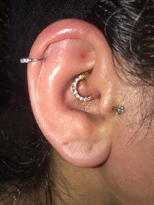 Piercing Infection Pricescope