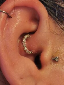 Piercing Infection Pricescope