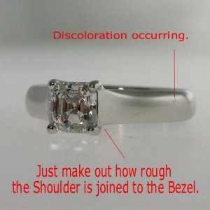 shoulderdiscol.JPG