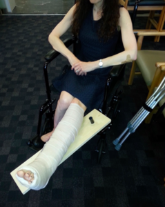 missybrokenleg.jpeg.png
