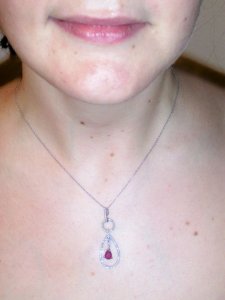 neckrph.jpg