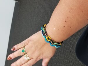 Mole on right forearm..jpg Mole on right forearm..jpg