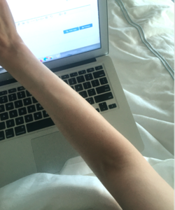 rightarmandbeautymarks.png
