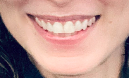 missysmile.png