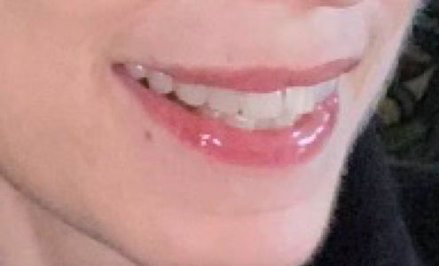missysmilecloseup.png
