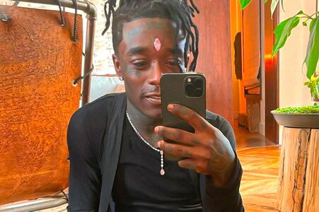 lil-uzi-vert-removes-24-million-usd-forehead-diamond-1.jpg