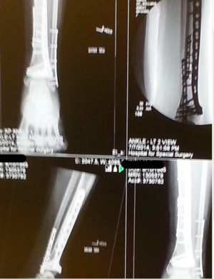 brokenlegmissy.png
