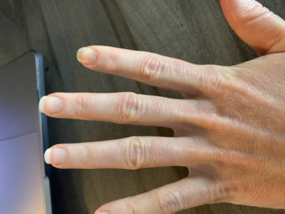 Plain finger shot for reference. Plain finger shot for reference.