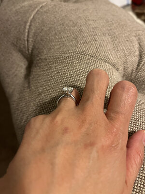 myring.jpg
