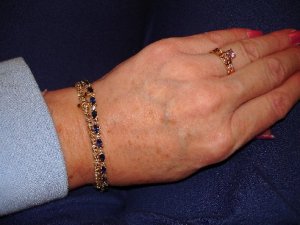 mcwristshot.JPG