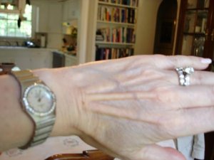 016wrist 2a.jpg