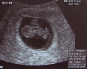 USno28wks1dHR162.JPG