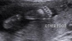 UltrasoundFeet.jpg