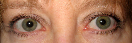 Eyes_1.jpg