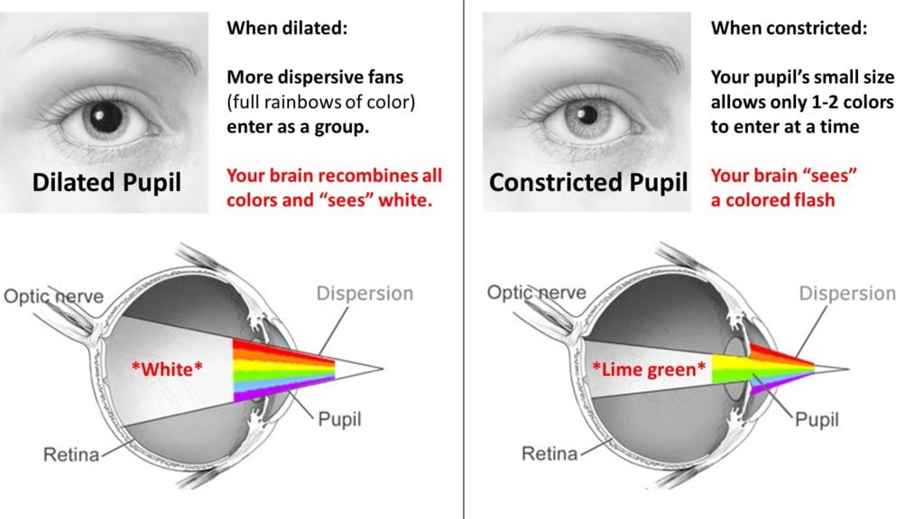 pupils dilated constricted